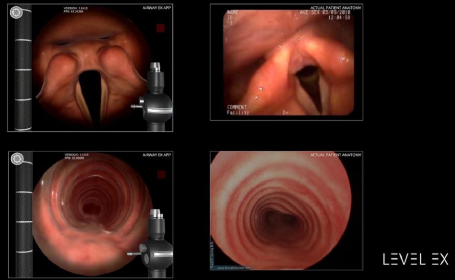 Level Ex lets doctors practice virtual surgery in a mobile app